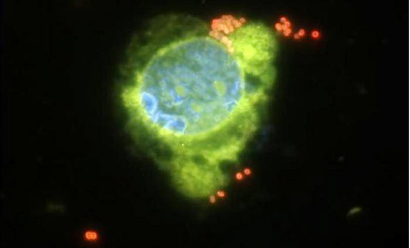 Significant Post COVID Resurgence In Invasive Meningococcal Disease   Photo Neisseria Meningitidi 