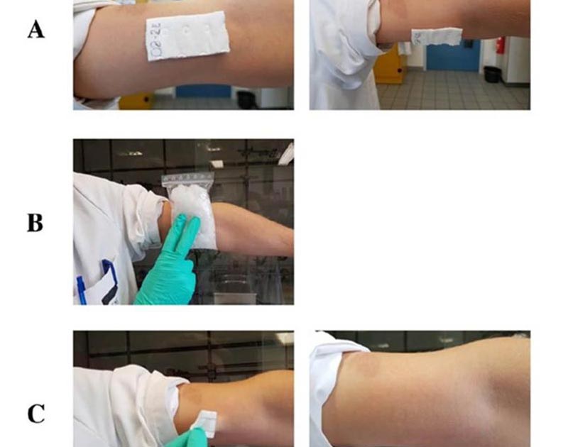 Innovative Polymer Wound Dressings for Painless and Residue-Free Removal - Innovations Report