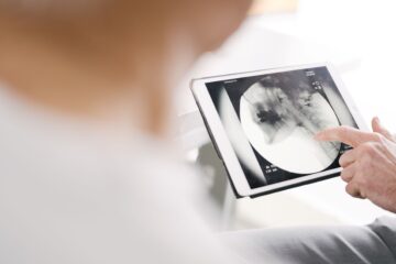 Videofluoroscopy used for diagnosing swallowing disorders in stroke patients.