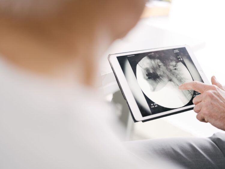 Videofluoroscopy used for diagnosing swallowing disorders in stroke patients.