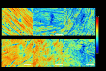 Mueller matrix polarimetry technique used for Achilles tendon healing evaluation.