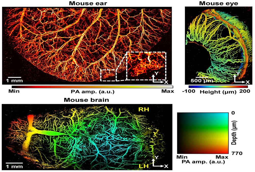 super-resolution-photoacoustic-microscopy-finds-clogged-blood-vessels